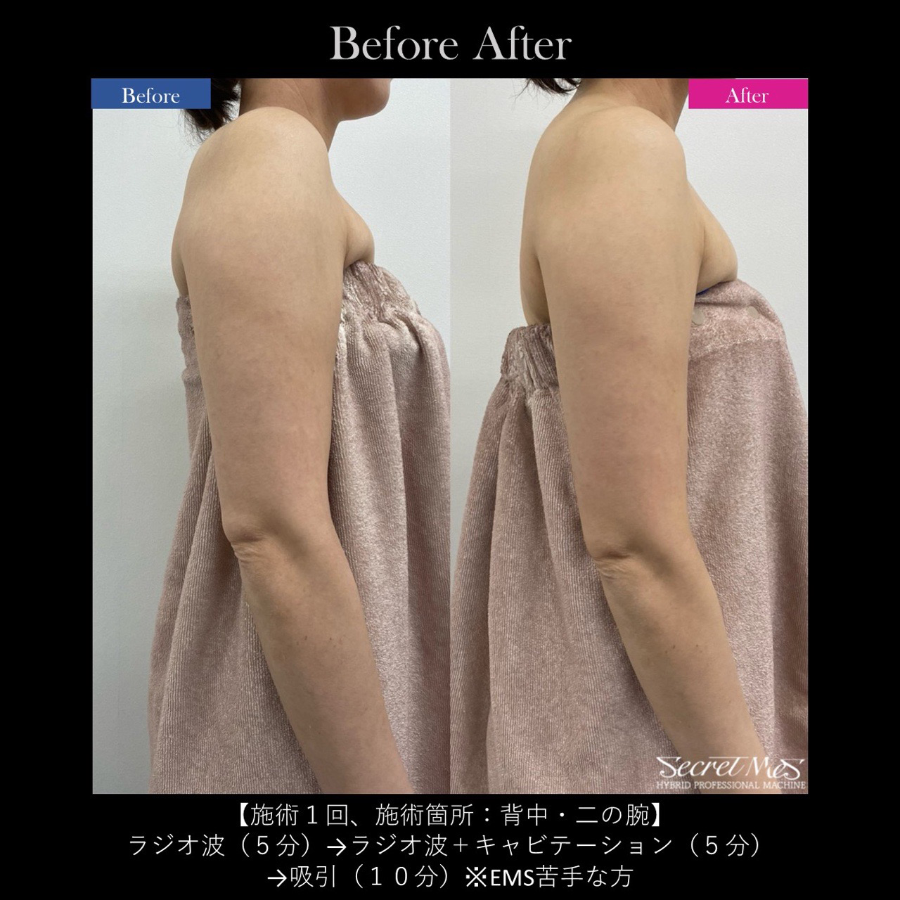 当サロンの施術事例