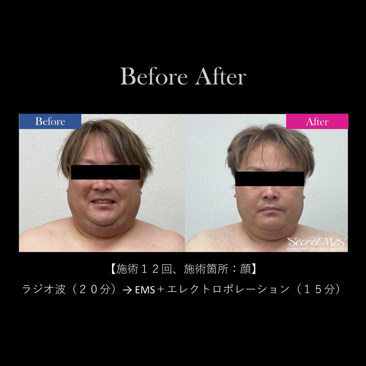 当サロンの施術事例