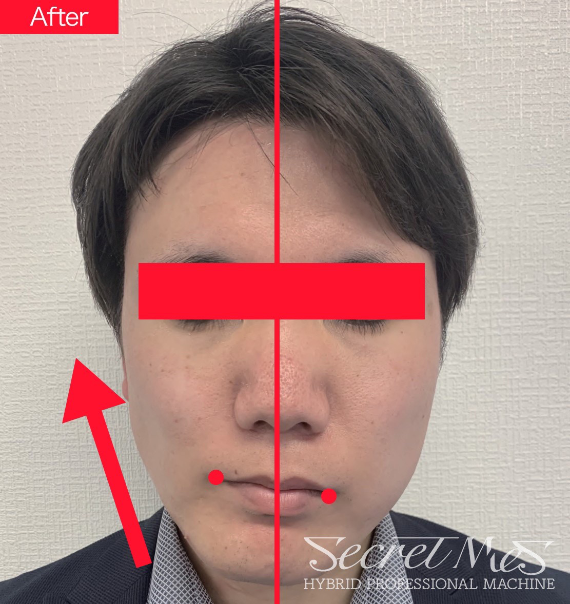当サロンの施術事例